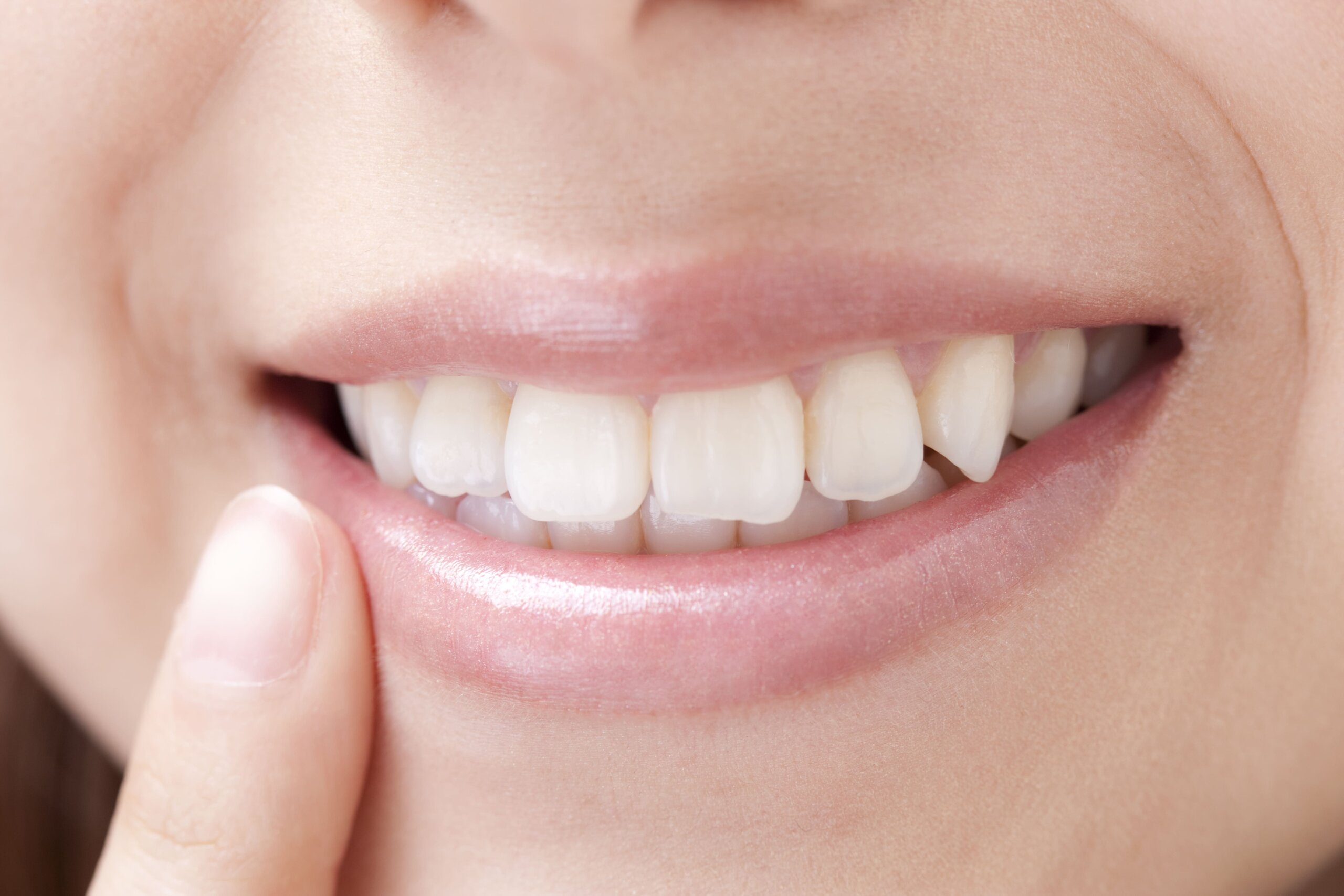 歯の黄ばみ・変色の原因